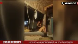 «Косять» від мобілізації: на росії хлопцеві зламали руку велетенською кувалдою (відео)