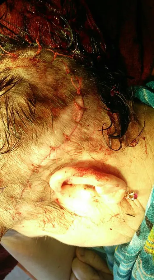Мало не зняв скальп: на Волині син зачепив матір вантажівкою (фото 18+)