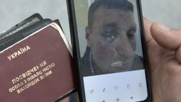У Луцьку розслідують побиття ветерана працівниками ТЦК: деталі справи (фото, відео)