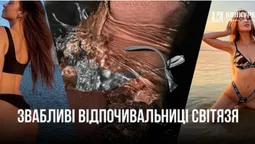 Світязькі відпочивальниці показали пляжні світлини з відпочинку