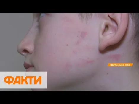 У ліцеї в Княгининку черговий побив шестикласника (відео)