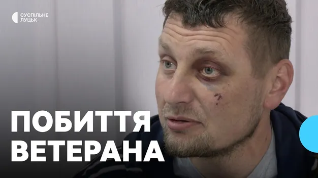 У Луцьку розслідують побиття ветерана працівниками ТЦК: деталі справи (фото, відео)