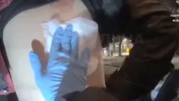 У центрі Луцька допомогли чоловікові з діркою у спині (відео)