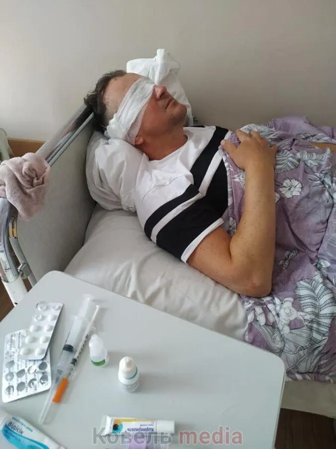 Сусідські війни: у Ковелі на лікаря-ветеринара напали з газовим балончиком (фото)