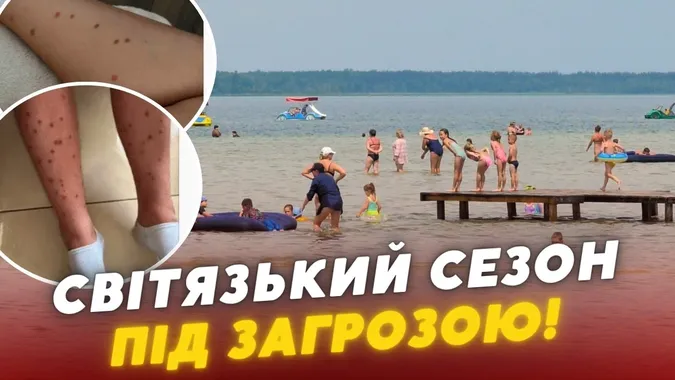 На Світязі нова хвиля скарг на висип після купання: воду досліджує екоінспекція (відео)