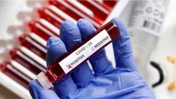 Колективний імунітет неможливий: розробник вакцини Oxford-AstraZeneca (відео)