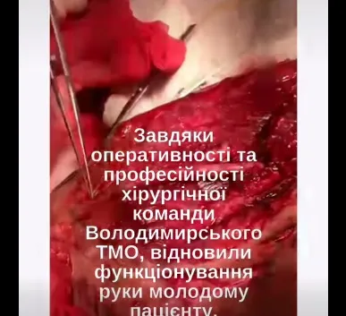 Врятували від ампутації: медики протезували 10 см артерії молодому волинянину (фото 18+)