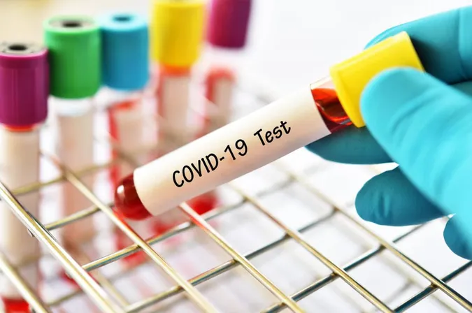 COVID в Україні йде на спад: нових випадків за тиждень поменшало на 3%