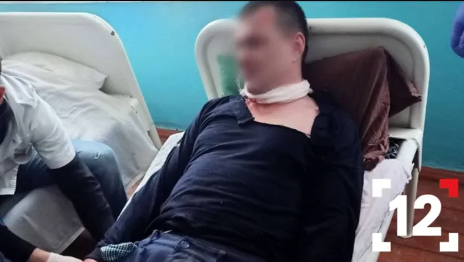 У Луцьку психічно хворий чоловік порізав собі обличчя лезом (відео)