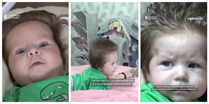 Малюк з Житомирщини народився з довжелезним волоссям (відео)