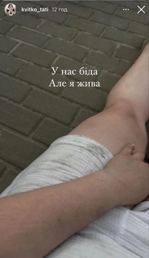 У  «супермами» з Київщини згорів будинок: у пожежі загинула жінка (фото)