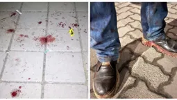 Штани та взуття були у крові: у Рівному затримали вбивцю-«гастролера» (фото)