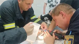 У Луцьку рятувальники допомагали хлопцю зняти перстень з пальця (фото)
