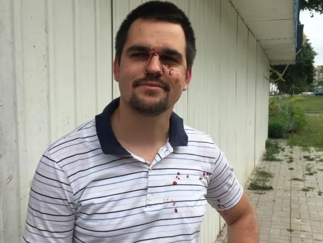 Поліція шукає свідків нападу на очільника волинського «Нацкорпусу»