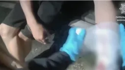 У Луцьку рятували юнака з закривавленою рукою (відео)