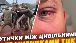 «Запшикали балончиком і душили»: на Волині ветеран заявив про побиття працівниками ТЦК (відео)