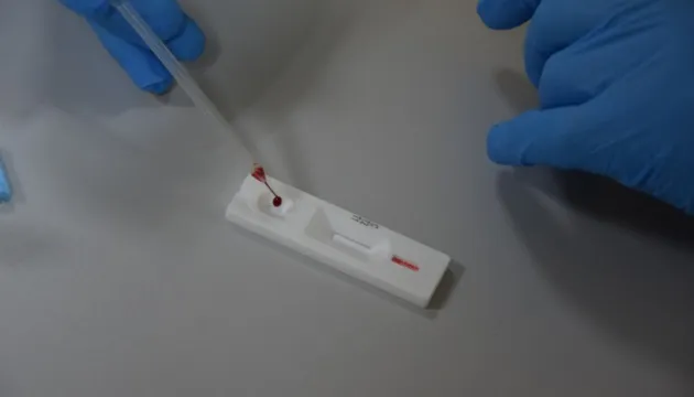 Україна закупить 6 мільйонів експрес-тестів на COVID-19