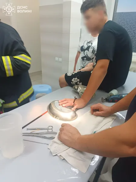 У Луцьку рятувальники допомагали хлопцю зняти перстень з пальця (фото)