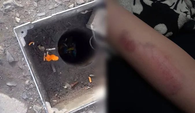 У центрі Луцька – глибоке провалля: травмувалась дитина (відео)