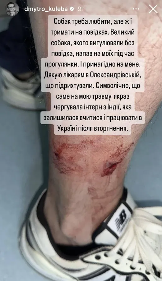 Голову МЗС Дмитра Кулебу покусав собака (фото)
