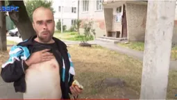«Будеш моєю квіточкою»: психічно хворий лучанин шукає собі жінку – демонструє геніталії (відео)