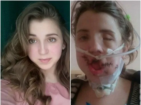 Юну волинянку, що постраждала в моторошній ДТП, зацькував волонтер (фото)