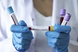 Коронавірус у Луцьку: за вихідні зафіксували 21 новий випадок