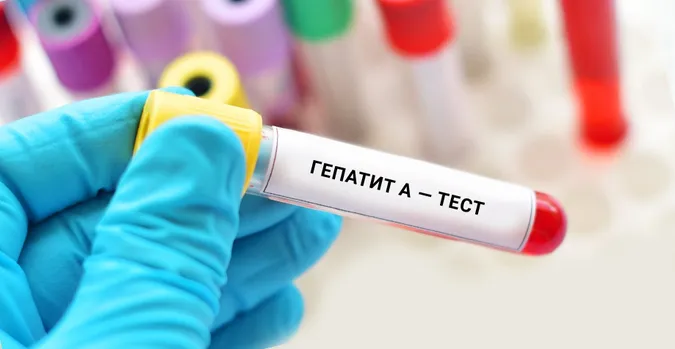 На Ковельщині зафіксували спалах гепатиту А: захворіли четверо дітей