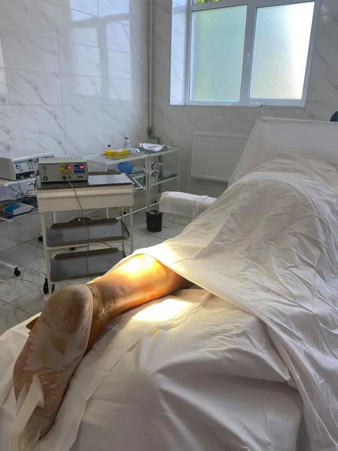 У Нововолинську прооперували чоловіка, який розірвав ахіллове сухожилля (фото)