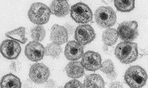 У Нідерландах виявили більш небезпечний варіант ВІЛ