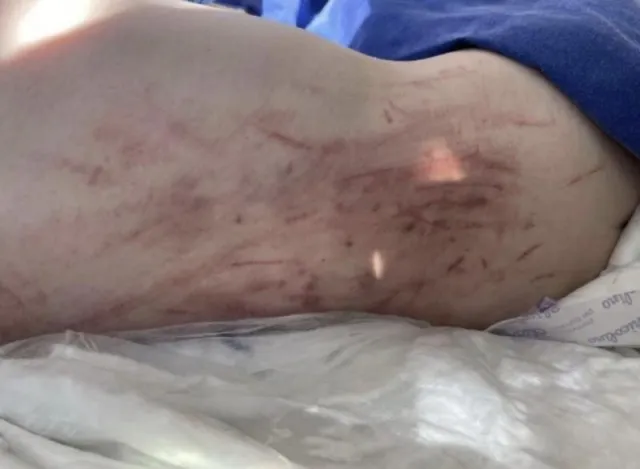 На Рівненщині дворічному хлопчику викололи око: підозрюють батьків