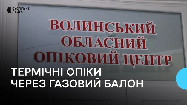 Постраждало обличчя і руки: під Луцьком двоє людей травмувались від полум'я з газового балона (відео)