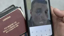 У Луцьку розслідують побиття ветерана працівниками ТЦК: деталі справи (фото, відео)
