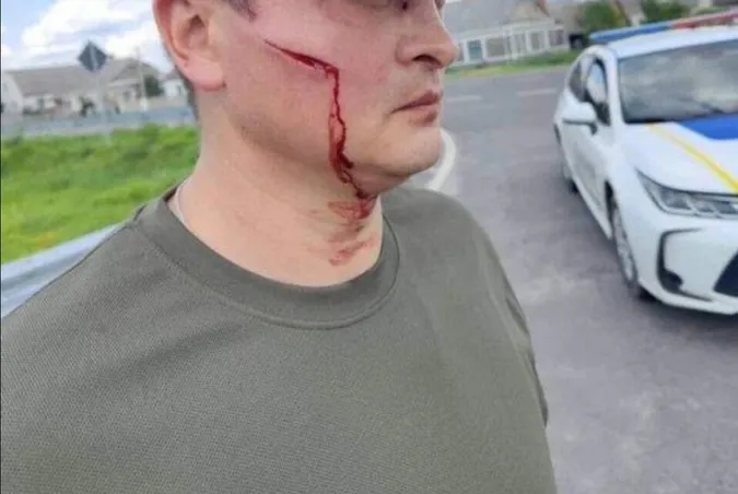 У Ковельському районі чоловік жорстоко побив працівника ТЦК