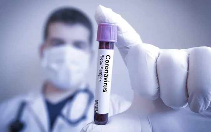 На Волині – 863 випадки COVID-19, в Україні – 22 811