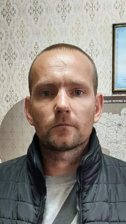 Шрам на лобі та щоці: волинянина розшукують за грабіж (фото)