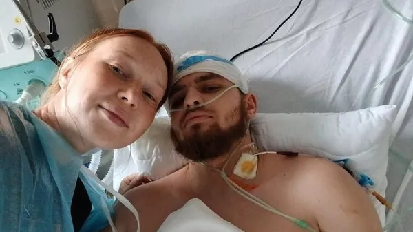 Поранення, 13 операцій і протез: історія волинянина, який у 19 років пішов добровольцем на фронт (відео)