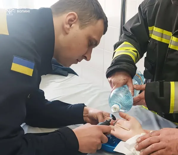 Аж набряк палець: у Луцьку дівчина наділа затісну каблучку (фото)