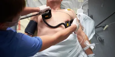 Клінічна смерть і відсутність пульсу: у Рокинях медики швидкої з того світу відкачали чоловіка
