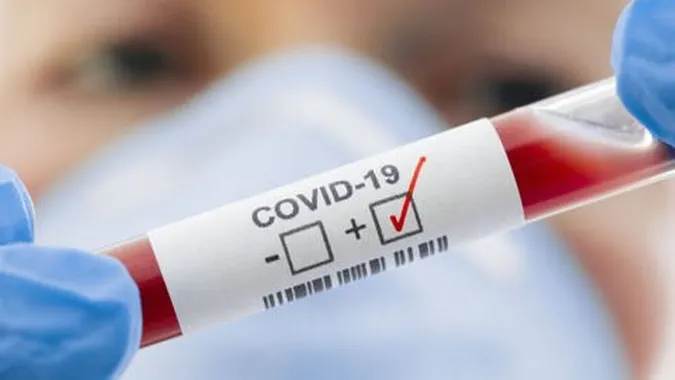 В Україні  11 913 хворих на COVID-19, на Волині – 324