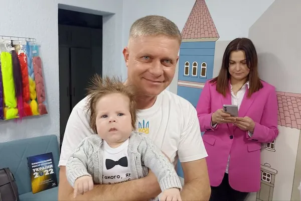 Малюк з Житомирщини народився з довжелезним волоссям (відео)
