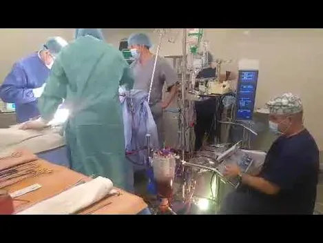 Як луцькі медики зупиняють і запускають серце: репортаж з операційної (фото, відео 18+)