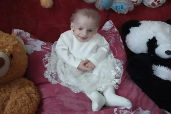 На Волині 8-річна дівчинка померла від передчасного старіння
