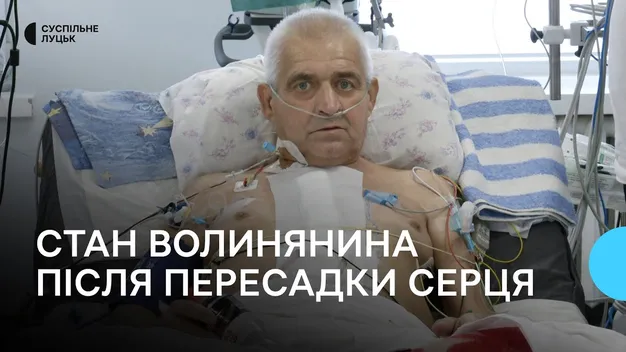 «Вдома чекають діти та онуки»: волинянин розповів як почувається після пересадки серця (фото, відео)