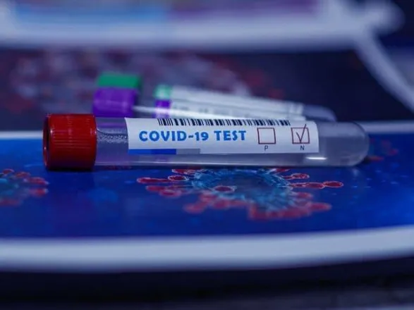 МОЗ фіксує в Україні випадки повторних заражень COVID-19