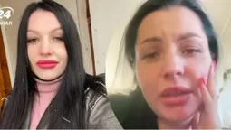 На мене війна не впливає: відома українська блогерка цинічно висловилась про ракетний удар в Сумах (відео)