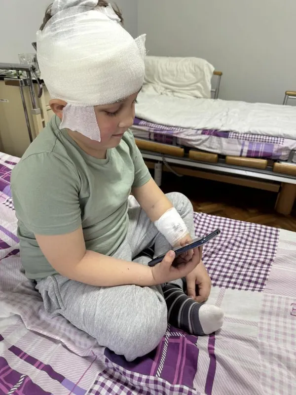 З голови маленького хлопчика з Волині видалили одну з найскладніших пухлин (фото)