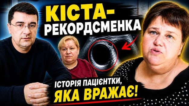 «Носила на собі відро води»: у Луцьку жінці видалили гігантську кісту (відео)