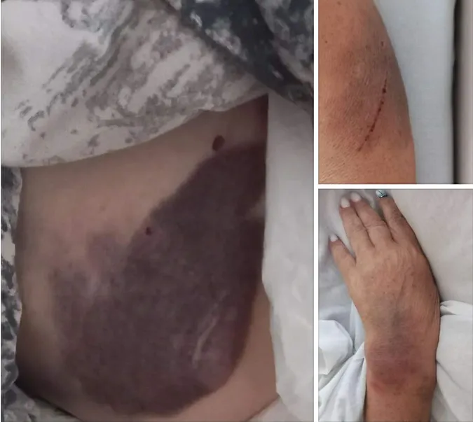 Син директора Рівненської АЕС побив жінку похилого віку, – ЗМІ (відео)