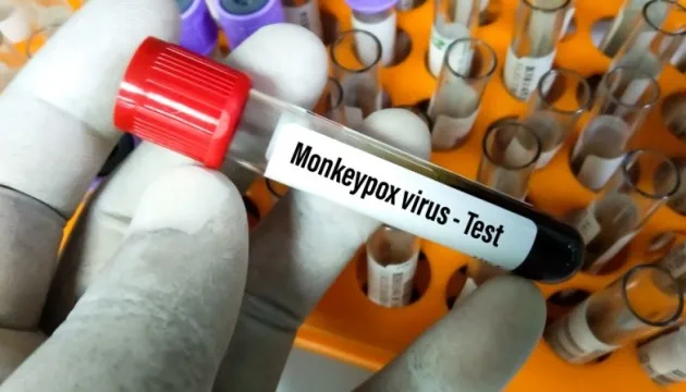 У Нідерландах виявили 167 випадків зараження мавпячою віспою